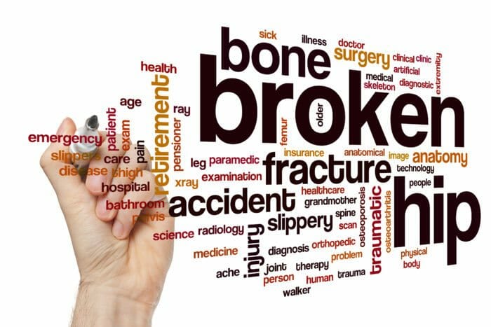Lawsuit - injury at Open House